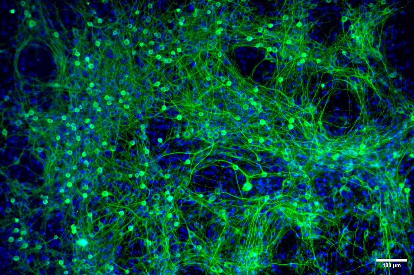 Microscope image: green neurons over blue nuclei.