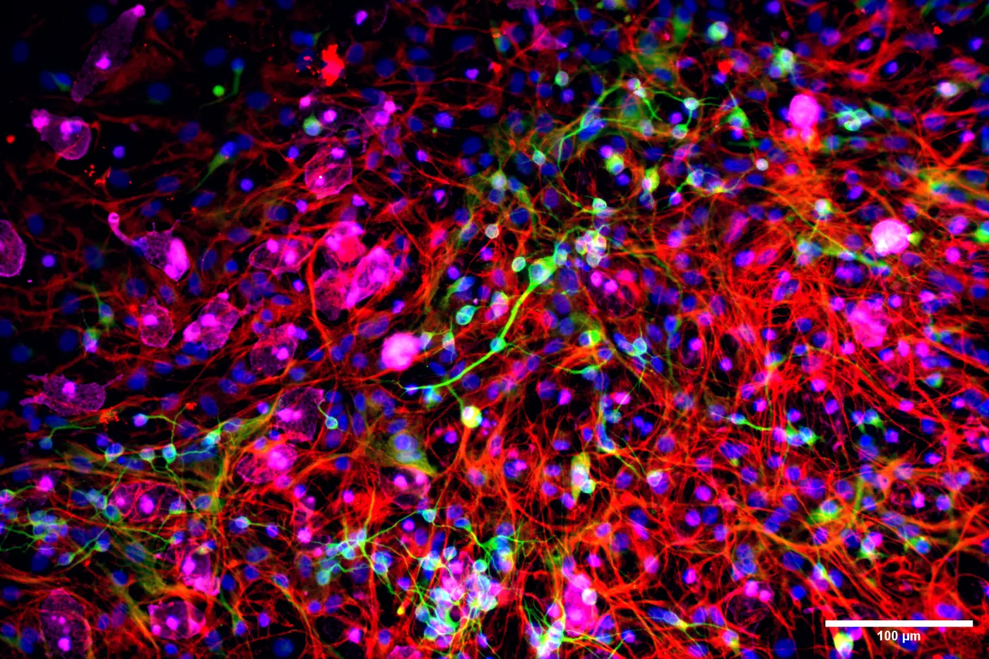 Microscope image: red and magenta neurons over blue nuclei.