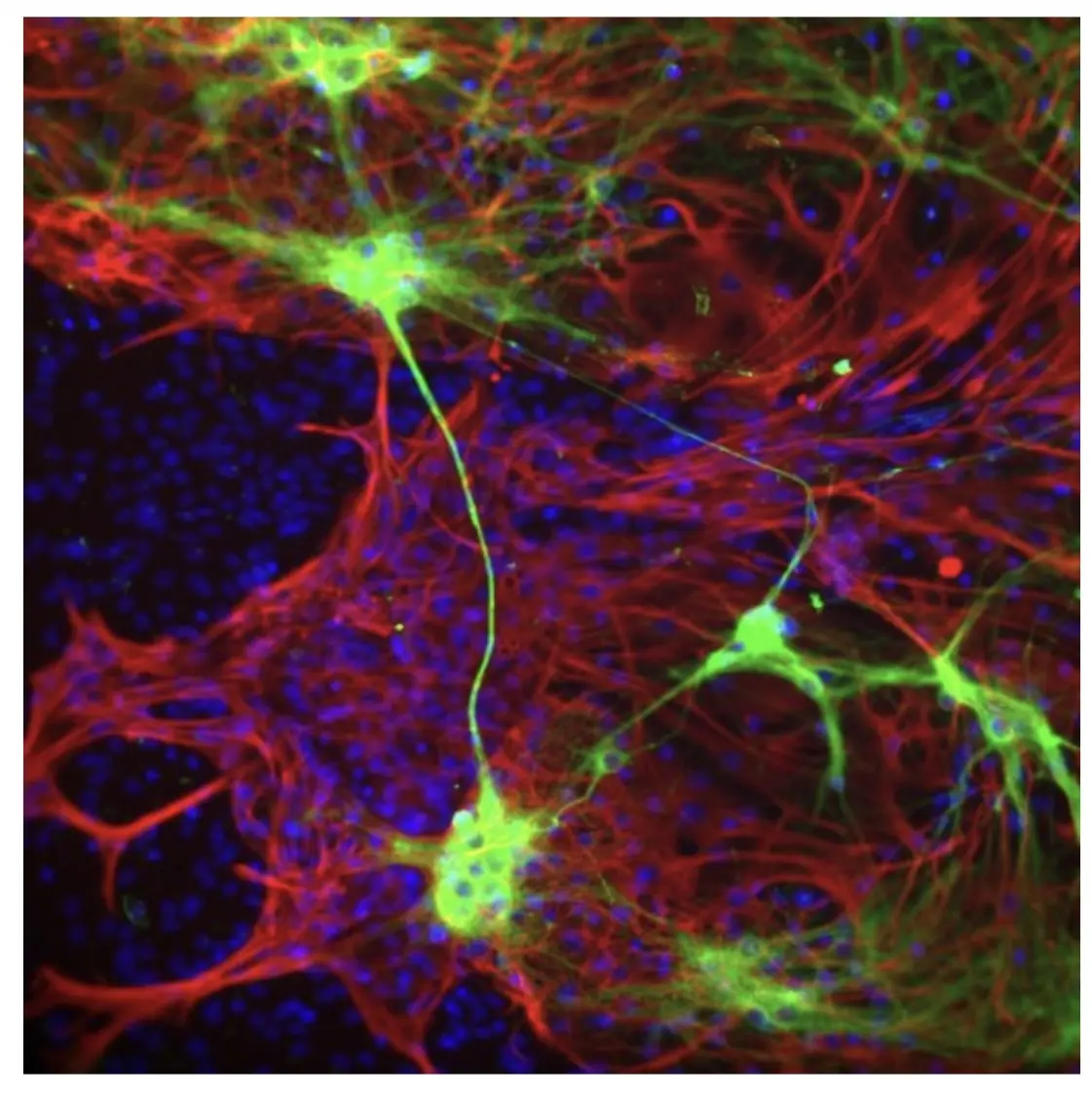 Microscope image: green and red astrocytes.