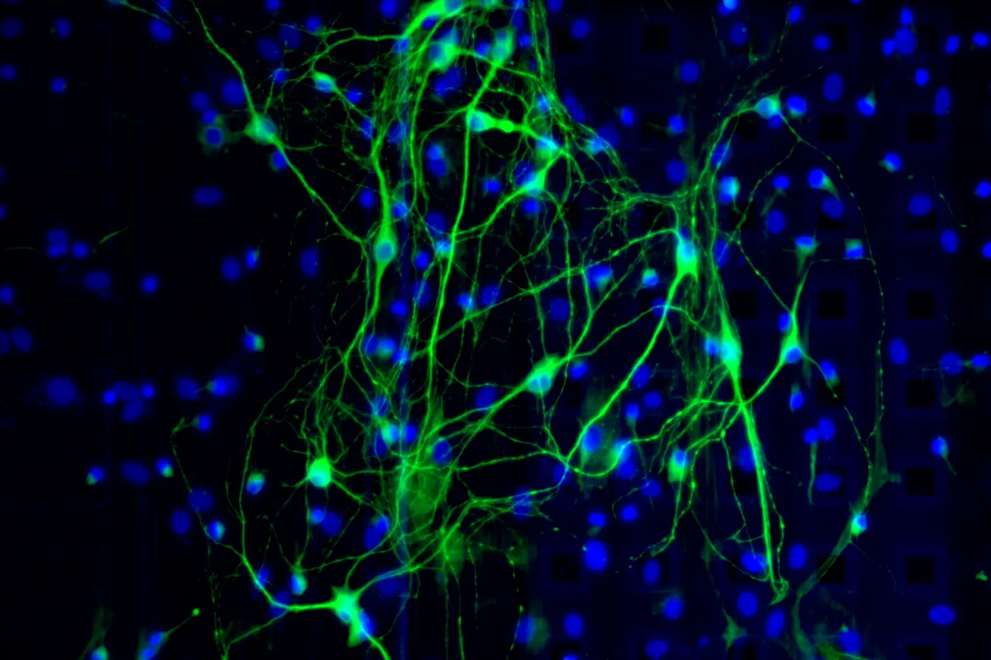 Microscope image: sparse green neurons over blue nuclei.
