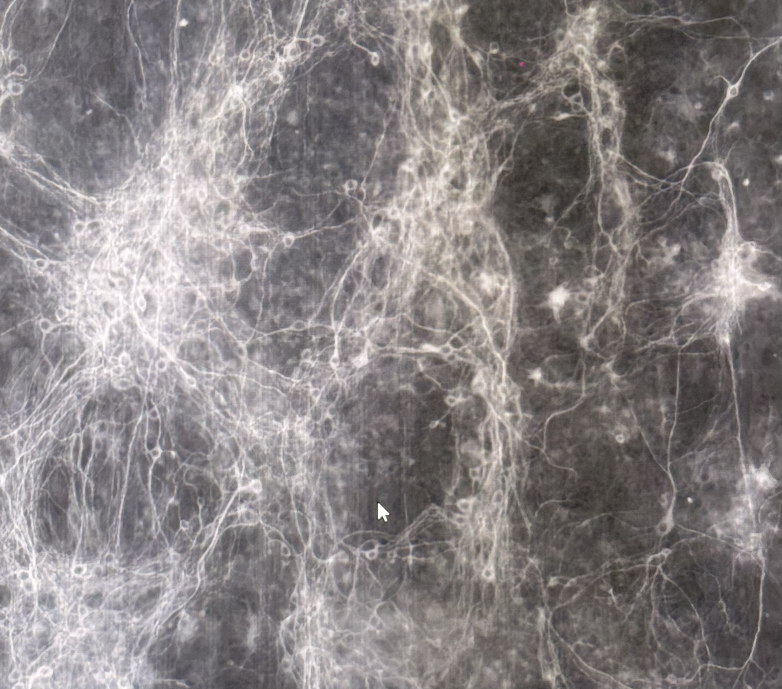 Microscope screen: a white network of neurons.
