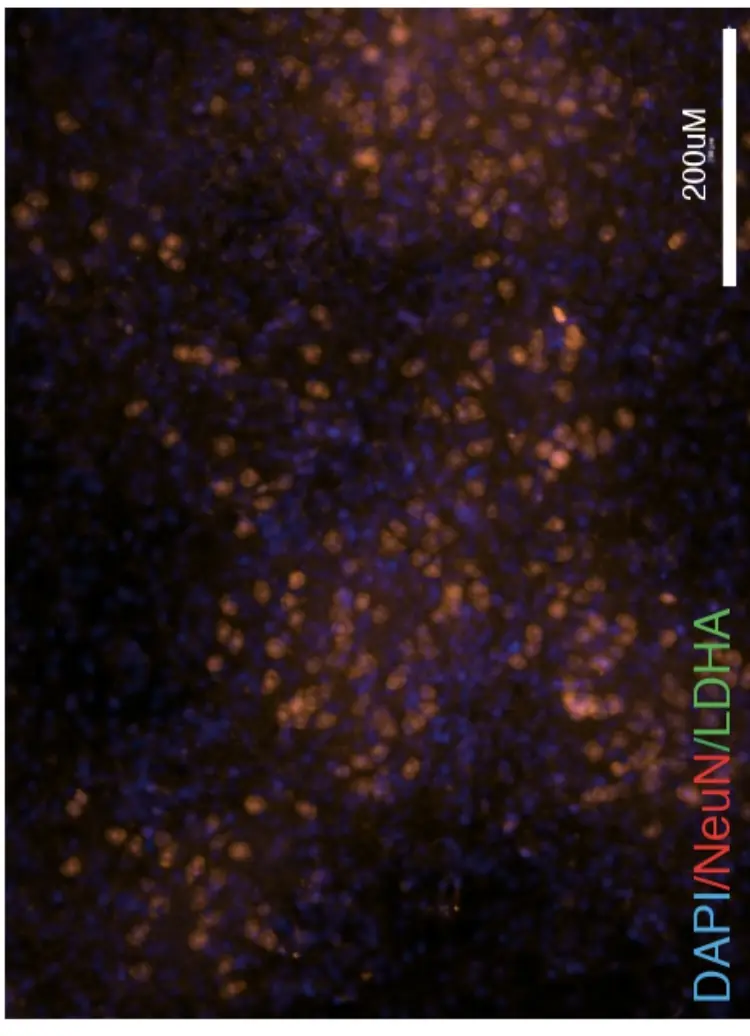 Source image: brain tissue stained with DAPI, NeuN and LDHA, sparse orange cells on blue.