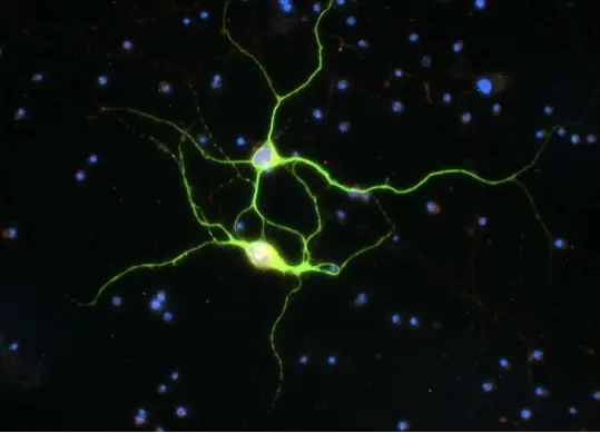 Source image: a single green fluorescent neuron among blue nuclei.