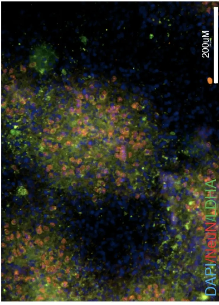 Source image: brain tissue stained with DAPI, NeuN and LDHA, dense with blue, green and orange cells.